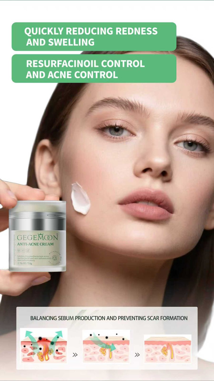 ANTI ACNE CREAM  50G