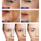 REDUCES WRINKLES CREAM 50G