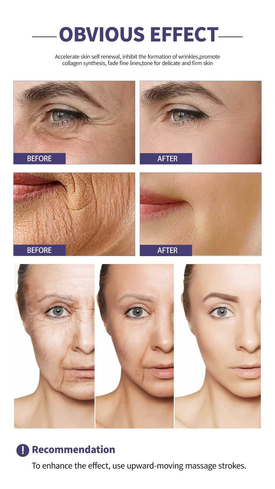 REDUCES WRINKLES CREAM 50G